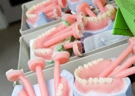 Herstellingen aan implantaten en tandprotheses